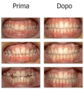 ortodonzia - dott.tangorra