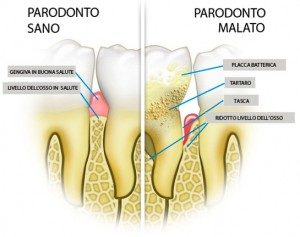parodontologia